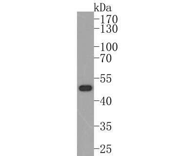 Western Blot: Nogo Antibody (JM02-34) [NBP2-75595] - Western blot analysis of Nogo on HeLa cell lysates. Proteins were transferred to a PVDF membrane and blocked with 5% BSA in PBS for 1 hour at room temperature. The primary antibody at 1:500 was used in 5% BSA at room temperature for 2 hours. A goat anti-rabbit IgG - HRP secondary antibody at 1:200,000 dilution was used for 1 hour at room temperature.