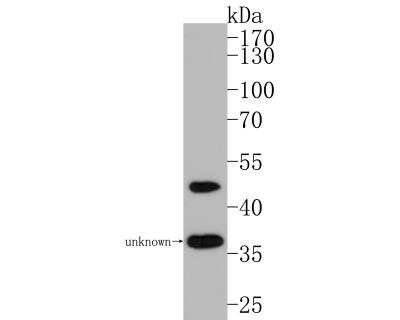 Western Blot: Nogo Antibody (JM02-34) [NBP2-75595] - Western blot analysis of Nogo on mouse skeletal muscle tissue lysates. Proteins were transferred to a PVDF membrane and blocked with 5% BSA in PBS for 1 hour at room temperature. The primary antibody at 1:500 was used in 5% BSA at room temperature for 2 hours. A goat anti-rabbit IgG - HRP secondary antibody at 1:200,000 dilution was used for 1 hour at room temperature.