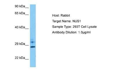 Western Blot: Nogo B receptor Antibody [NBP2-85390] - Host: Rabbit. Target Name: NUS1. Sample Tissue: Human 293T Whole Cell lysates. Antibody Dilution: 1ug/ml
