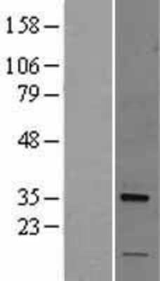 Western Blot Nogo B receptor Overexpression Lysate