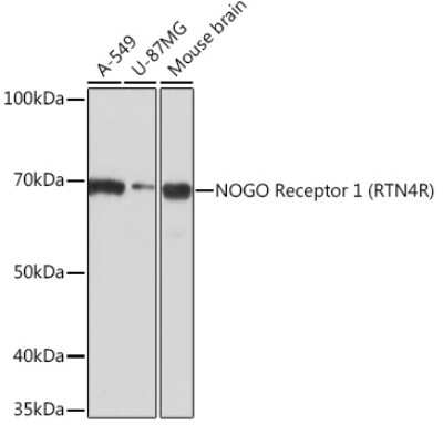 Western Blot: Nogo Receptor/NgR Antibody (1R9A3) [NBP3-16299] - Western blot analysis of extracts of various cell lines, using Nogo Receptor/NgR Rabbit mAb (NBP3-16299) at 1:1000 dilution. Secondary antibody: HRP Goat Anti-Rabbit IgG (H+L) at 1:10000 dilution. Lysates/proteins: 25ug per lane. Blocking buffer: 3% nonfat dry milk in TBST. Detection: ECL Basic Kit. Exposure time: 3min.