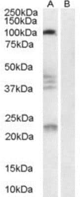 Western Blot: Nogo Receptor/NgR Antibody [NB100-1536] - (0.3ug/ml) staining of Human Brain lysate (35ug protein in RIPA buffer) with (B) and without (A) blocking with the immunising peptide. Primary incubation was 1 hour. Detected by chemiluminescence.