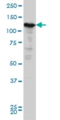 Western Blot: Nope Antibody (6E6) [H00057722-M03] - Analysis of NOPE expression in HeLa (Cat # L013V1).