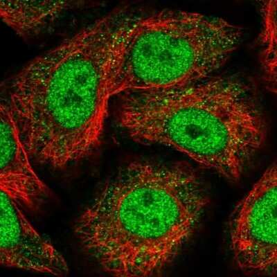 Immunocytochemistry/Immunofluorescence: Nope Antibody [NBP1-92195] - Staining of human cell line A549 shows localization to nucleoplasm & cytosol. Antibody staining is shown in green.