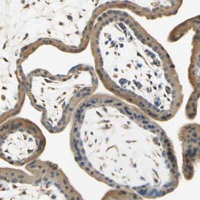 Immunohistochemistry-Paraffin: Nope Antibody [NBP1-92195] - Staining of human placenta shows cytoplasmic positivity in trophoblastic cells.