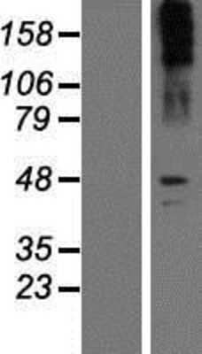 Western Blot: Noradrenaline transporter Overexpression Lysate (Adult Normal) [NBP2-10902] Left-Empty vector transfected control cell lysate (HEK293 cell lysate); Right -Over-expression Lysate for Noradrenaline transporter.