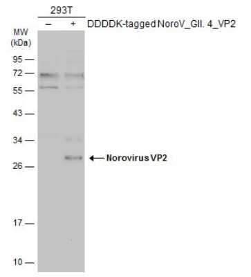 Western Blot: Norovirus VP2 Antibody [NBP3-13385] - Non-transfected (-) and transfected (+) 293T whole cell extracts (30 ug) were separated by 12% SDS-PAGE, and the membrane was blotted with Norovirus VP2 antibody (NBP3-13385) diluted at 1:5000. The HRP-conjugated anti-rabbit IgG antibody (NBP2-19301) was used to detect the primary antibody.
