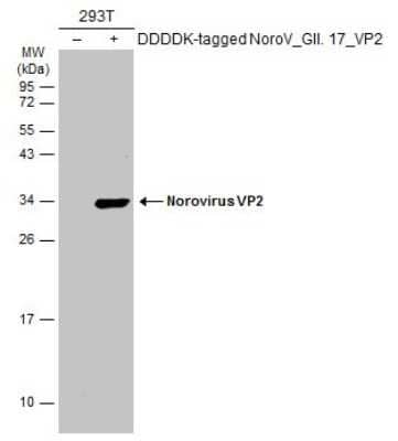 Western Blot: Norovirus VP2 Antibody [NBP3-13386] - Non-transfected (-) and transfected (+) 293T whole cell extracts (30 ug) were separated by 12% SDS-PAGE, and the membrane was blotted with Norovirus VP2 antibody (NBP3-13386) diluted at 1:5000. The HRP-conjugated anti-rabbit IgG antibody (NBP2-19301) was used to detect the primary antibody.