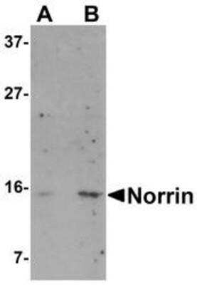 Western Blot: Norrin/NDP Antibody [NBP1-77014] - Jurkat cell lysate with Norrin antibody at (A) 1 and (B) 2 ug/mL.