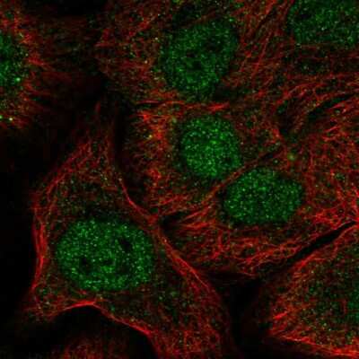 Immunocytochemistry/Immunofluorescence: Notch-1 Antibody [NBP2-57913] - Staining of human cell line HaCaT shows localization to nucleoplasm.
