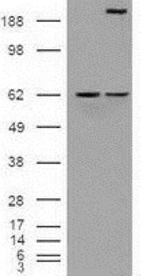 Western Blot: Notch-1 Antibody (OTI3E12) - Azide and BSA Free [NBP2-73042] - HEK293T cells were transfected with the pCMV6-ENTRY control (Left lane) or pCMV6-ENTRY Notch1(Right lane) cDNA for 48 hrs and lysed. Equivalent amounts of cell lysates (5 ug per lane) were separated by SDS-PAGE and immunoblotted with anti-Notch1.