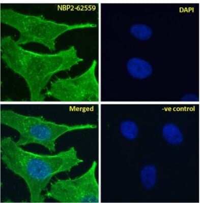 Immunocytochemistry/Immunofluorescence: Notch-2 Antibody (B6) - Chimeric [NBP2-62559] - Immunofluoresence staining of fixed HeLa cells with anti-Notch 2 antibody B6. Immunofluorescence analysis of paraformaldehyde fixed HeLa cells, permeabilized with 0.15% Triton stained with the chimeric rabbit IgG version of B6 (NBP2-62559) at 10 ug/ml for 1h followed by Alexa Fluor 488 secondary antibody (1 ug/ml), showing membrane staining. The nuclear stain is DAPI (blue). Panels show from left-right, top-bottom NBP2-62559, DAPI, merged channels and a negative control. The negative control was stained with unimmunized rabbit IgG followed by Alexa Fluor 488 secondary antibody.