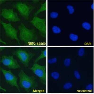 Immunocytochemistry/Immunofluorescence: Notch-2 Antibody (B9) - Chimeric [NBP2-62560] - Immunofluoresence staining of fixed HeLa cells with anti-Notch 2 antibody B9. Immunofluorescence analysis of paraformaldehyde fixed HeLa cells, permeabilized with 0.15% Triton stained with the chimeric rabbit IgG version of B9 (NBP2-62560) at 10 ug/ml for 1h followed by Alexa Fluor 488 secondary antibody (1 ug/ml), showing cytoplasmic staining. The nuclear stain is DAPI (blue). Panels show from left-right, top-bottom NBP2-62560, DAPI, merged channels and a negative control. The negative control was stained with unimmunized rabbit IgG followed by Alexa Fluor 488 secondary antibody.