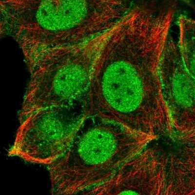 Immunocytochemistry/Immunofluorescence: Notch-2 Antibody [NBP2-48913] - Immunofluorescent staining of human cell line MCF7 shows localization to nucleoplasm & plasma membrane.