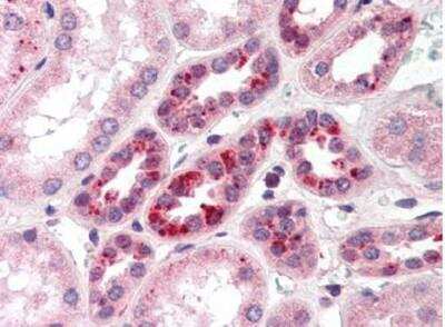 Immunohistochemistry-Paraffin: Notch-2 Antibody [NB600-879] - Diluted 1:500 to detect Notch-2 in human kidney tissue. Tissue was formalin fixed and paraffin embedded. No pre-treatment of sample was required. The image shows the localization of antibody as the precipitated red signal, with a hematoxylin purple nuclear counter stain.