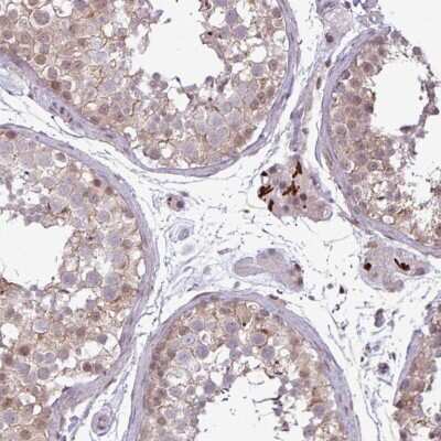 Immunohistochemistry-Paraffin: Notch-2 Antibody [NBP2-48913] - Staining of human testis shows strong nuclear positivity in Leydig cells.