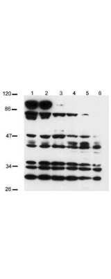 Western Blot: Notch-2 Antibody [NB600-879] - Analysis of a band at 110 kDa corresponding to active Notch 2 protein (arrowhead). Analysis was performed for Notch 2 expression using 100ug of total protein lysate obtained from human mesothelial SV40 cells transfected with a plasmid encoding a constitutively active Notch 2 (intra cellular Notch 2). Lanes 1-3 contain lysate 24 h (1), 48 h (2), and 72 h (3) post transfection. Lanes 4-6 are the corresponding control cells (untransfected) taken at similar time points. The band at about 110kD represents active Notch 2. This band is not seen in the control cell. The intracellular domain of Notch 2 has a predicted band size of 110kD, corresponding to this band. Protein cell lysates were run on a 10% SDS-page gel, blotted onto Hybond C membrane, blocked overnight in PBS-Tween 20 supplemented with 5% Non-fat Milk and probed with anti-Notch 2 at a 1:400 dilution. ECL was used as visualization method.