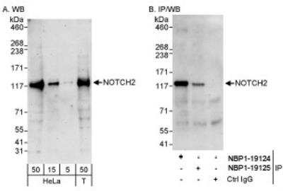 Western Blot: Notch-2 Antibody [NBP1-19125] - Whole cell lysate from HeLa and 293T cells. Notch2 was also immunoprecipitated by rabbit anti-Notch2 antibody NBP1-19124.