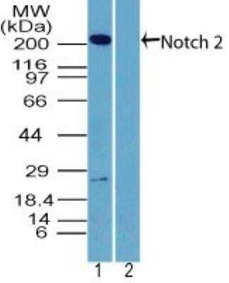 Western Blot: Notch-2 Antibody [NBP2-27347] -  Analysis of NOTCH2 in human brain lysate in the 1) absence and 2) presence of immunizing peptide using NBP2-27347 at 2 ug/ml. Goat anti-rabbit Ig HRP secondary antibody and PicoTect ECL substrate solution were used for this test.