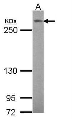 Western Blot: Notch-3 Antibody [NBP2-19567] -  Sample (30 ug of whole cell lysate) A: Hela 5% SDS PAGE gel, diluted at 1:1000.