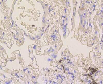 Immunohistochemistry-Paraffin: Notch1b Antibody (SJ205) [NBP2-67420] - Analysis of paraffin-embedded human lung tissue using anti-Notch 1 antibody. Counter stained with hematoxylin.