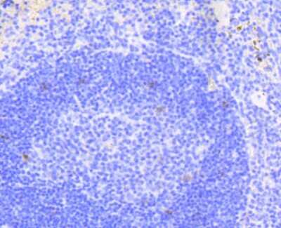 Immunohistochemistry-Paraffin: Notch1b Antibody (SJ205) [NBP2-67420] - Analysis of paraffin-embedded mouse spleen tissue using anti-Notch 1 antibody. Counter stained with hematoxylin.