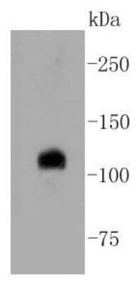 Western Blot: Notch1b Antibody (SJ205) [NBP2-67420] - Analysis of Notch 1 on HepG2 cell lysates using anti-Notch 1 antibody at 1/1,000 dilution.