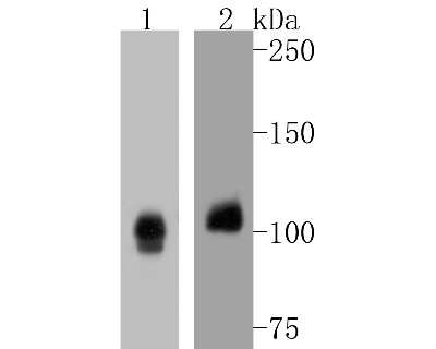 Western Blot: Notch1b Antibody (SJ205) [NBP2-67420] - Western blot analysis of Notch1b on different lysates. Proteins were transferred to a PVDF membrane and blocked with 5% BSA in PBS for 1 hour at room temperature. The primary antibody (1/500) was used in 5% BSA at room temperature for 2 hours. Goat Anti-R