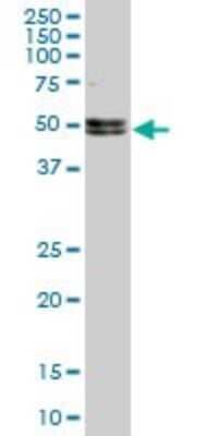 Western Blot Nova1 Antibody (5D9) - Azide and BSA Free
