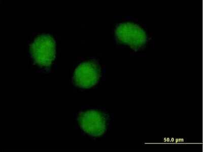 Immunocytochemistry/Immunofluorescence: Nova1 Antibody [H00004857-B01P] - Analysis of purified antibody to NOVA1 on HeLa cell. (antibody concentration 10 ug/ml)