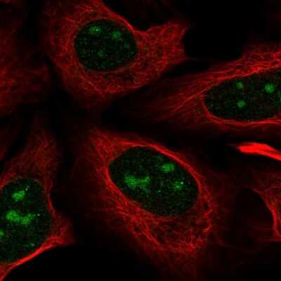 Immunocytochemistry/ Immunofluorescence Nova1 Antibody - BSA Free