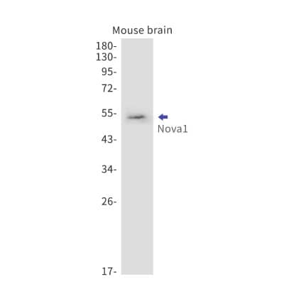 Western Blot: Nova1 Antibody (S06-8K6) [NBP3-19720] - Western blot detection of Nova1 in Rat lung cell lysates using NBP3-19720. Observed band size: 52kDa.