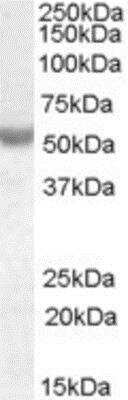 Western Blot: Nova1 Antibody [NBP1-00221] - Analysis of Nova1 in Human Breast Cancer lysate (35 ug protein in RIPA buffer) using NBP1-00221 at 0.01 ug/mL. Detected by chemiluminescence.