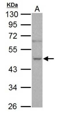 Western Blot: Nova1 Antibody [NBP1-32459] - Sample (30 ug of whole cell lysate) A: PC-3 10% SDS PAGE; antibody diluted at 1:1000.