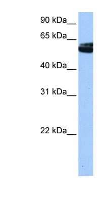Western Blot: Nova1 Antibody [NBP1-57397] - Hela cell lysate, concentration 0.2-1 ug/ml.