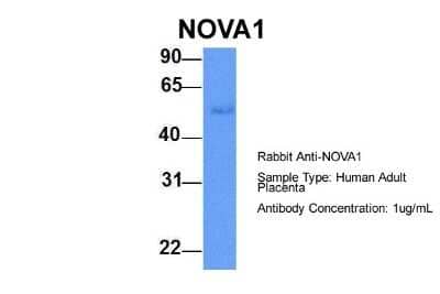 Western Blot: Nova1 Antibody [NBP1-57397] - Human Adult Placenta, Antibody Dilution: 1.0 ug/ml.