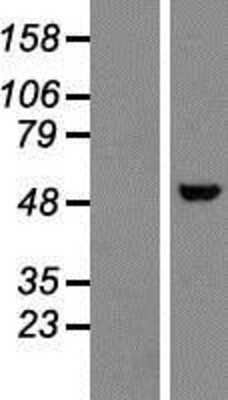 Western Blot Nova1 Overexpression Lysate