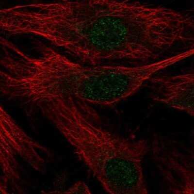 Immunocytochemistry/Immunofluorescence: Nox4 Antibody [NBP2-54670] - Staining of human cell line HUVEC TERT2 shows localization to nucleus.