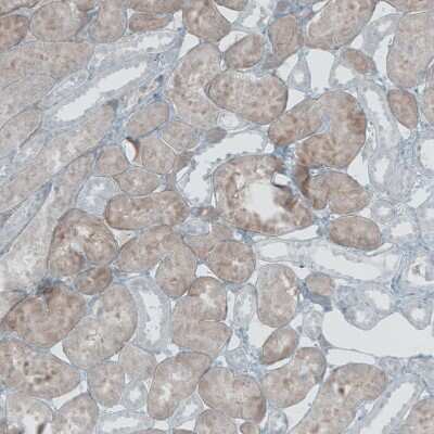Immunohistochemistry-Paraffin: Nox4 Antibody [NBP2-54670] - Staining of human kidney shows weak to moderate cytoplasmic positivity in cells in proximal tubules.