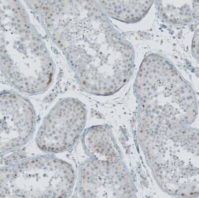 Immunohistochemistry-Paraffin: Nox4 Antibody [NBP2-54670] - Staining of human testis shows weak cytoplasmic positivity in cells in seminiferous ducts.