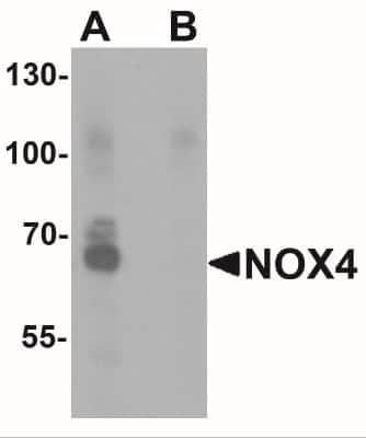 Western Blot: Nox4 Antibody [NBP2-41293] - Analysis of NOX4 in Jurkat cell lysate with NOX4 antibody at 1 ug/ml in (A) the absence and (B) the presence of blocking peptide.