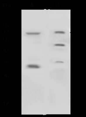 Western Blot: Nox4 Antibody [NBP2-99109] - Anti-Nox4 rabbit polyclonal antibody at 1:500 dilution. Lane A: 293 Whole Cell Lysate Lane B: HepG2 Whole Cell Lysate Lysates/proteins at 30 ug per lane. Secondary Goat Anti-Rabbit IgG (H+L)/HRP at 1/10000 dilution. Developed using the ECL technique. Performed under reducing conditions. Predicted band size: 67 kDa. Observed band size: 67 kDa