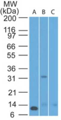 Western Blot: Noxa Antibody (69N15G8) [NBP2-25252] - Analysis of mouse (A) Noxa recombinant protein, (B) thymus, and (C) ovary using Noxa antibody at 1 ug/mL, 5 ug/mL and 5 ug/mL, respectively.