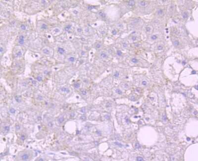 Immunohistochemistry-Paraffin: Noxa Antibody (JA30-03) [NBP2-66989] - Immunohistochemical analysis of paraffin-embedded human liver tissue using anti-Noxa antibody. Counter-stained with hematoxylin.