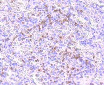 Immunohistochemistry-Paraffin: Noxa Antibody (JA30-03) [NBP2-66989] - Immunohistochemical analysis of paraffin-embedded human spleen tissue using anti-Noxa antibody. Counter-stained with hematoxylin.