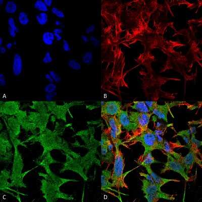 Immunocytochemistry/Immunofluorescence: NrCAM Antibody (S364-51) [NBP2-42191] - Immunocytochemistry/Immunofluorescence analysis using Mouse Anti-NrCAM Monoclonal Antibody, Clone S364-51 (NBP2-42191). Tissue: Neuroblastoma cell line (SK-N-BE). Species: Human. Fixation: 4% Formaldehyde for 15 min at RT. Primary Antibody: Mouse Anti-NrCAM Monoclonal Antibody (NBP2-42191) at 1:100 for 60 min at RT. Secondary Antibody: Goat Anti-Mouse ATTO 488 at 1:100 for 60 min at RT. Counterstain: Phalloidin Texas Red F-Actin stain; DAPI (blue) nuclear stain at 1:1000, 1:5000 for 60min RT, 5min RT. Localization: Cell Membrane. Magnification: 60X. (A) DAPI (blue) nuclear stain. (B) Phalloidin Texas Red F-Actin stain. (C) NrCAM Antibody. (D) Composite.