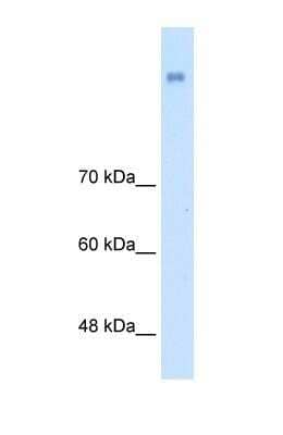 Western Blot: NrCAM Antibody [NBP1-59501] - HepG2 cell lysate, Antibody Titration: 2.5ug/ml