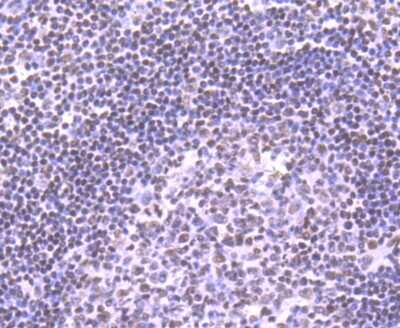 Immunohistochemistry-Paraffin: Nrf1 Antibody (JM89-63) [NBP2-75597] - Analysis of paraffin-embedded human tonsil tissue using anti-NRF1 antibody. Counter stained with hematoxylin.