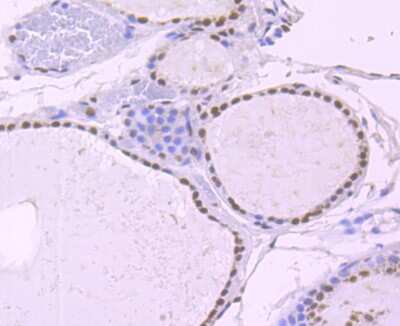 Immunohistochemistry-Paraffin: Nrf1 Antibody (JM89-63) [NBP2-75597] - Analysis of paraffin-embedded human thyriod tissue using anti-NRF1 antibody. Counter stained with hematoxylin.