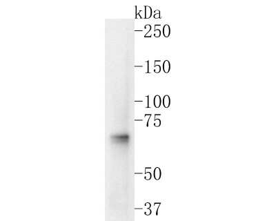 Western Blot: Nrf1 Antibody (JM89-63) [NBP2-75597] - Western blot analysis of Nrf1 on Hela cell lysates. Proteins were transferred to a PVDF membrane and blocked with 5% BSA in PBS for 1 hour at room temperature. The primary antibody (1/500) was used in 5% BSA at room temperature for 2 hours. Goat Anti-Rabbit IgG - HRP Secondary Antibody (HA1001) at 1:5,000 dilution was used for 1 hour at room temperature.